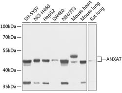 Invitrogen Annexin A7 Polyclonal Antibody 100 &mu;L; Unconjugated:Antibodies,