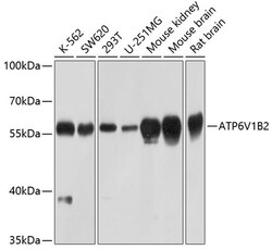 Invitrogen ATP6V1B2 Polyclonal Antibody 100 &mu;L; Unconjugated:Antibodies,