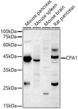 Invitrogen Carboxypeptidase A1 Polyclonal Antibody 100 &mu;L; Unconjugated:Antibodies,