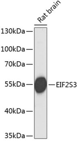 Invitrogen eIF2 gamma Polyclonal Antibody 100 &mu;L; Unconjugated:Antibodies,