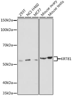 Invitrogen KRT81 Polyclonal Antibody 100 &mu;L; Unconjugated:Antibodies,