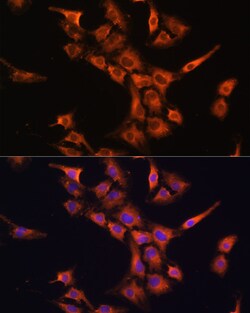 Invitrogen PFDN5 Polyclonal Antibody 100 &mu;L; Unconjugated:Antibodies,