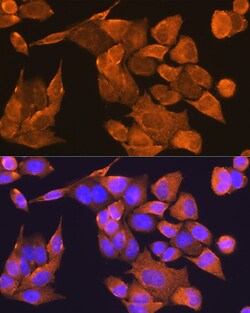 Invitrogen PFDN5 Polyclonal Antibody 100 &mu;L; Unconjugated:Antibodies,