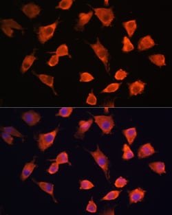 Invitrogen PFDN5 Polyclonal Antibody 100 &mu;L; Unconjugated:Antibodies,