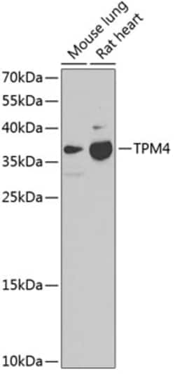 Invitrogen TPM4 Polyclonal Antibody 100 &mu;L; Unconjugated:Antibodies,