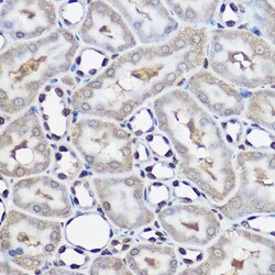 Invitrogen UBE2L3 Polyclonal Antibody 100 &mu;L; Unconjugated:Antibodies,