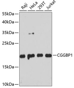 Invitrogen CGGBP1 Polyclonal Antibody 100 &mu;L | Buy Online | Invitrogen&trade; | Fisher Scientific