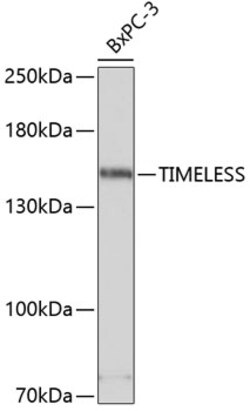 Invitrogen TIMELESS Polyclonal Antibody 100 &mu;L; Unconjugated:Antibodies,
