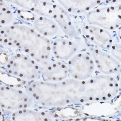 Invitrogen BCAS2 Polyclonal Antibody 100 &mu;L | Buy Online | Invitrogen&trade; | Fisher Scientific