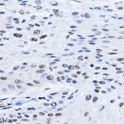 Invitrogen BCAS2 Polyclonal Antibody 100 &mu;L | Buy Online | Invitrogen&trade; | Fisher Scientific