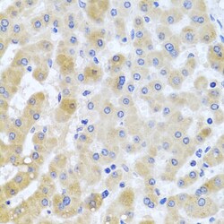 Invitrogen PCID1 Polyclonal Antibody 100 &mu;L; Unconjugated:Antibodies,