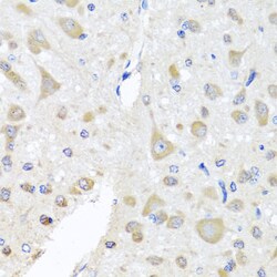 Invitrogen PCID1 Polyclonal Antibody 100 &mu;L; Unconjugated:Antibodies,