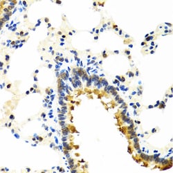 Invitrogen CRTAP Polyclonal Antibody 100 &mu;L; Unconjugated:Antibodies,
