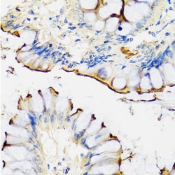 Invitrogen CRTAP Polyclonal Antibody 100 &mu;L; Unconjugated:Antibodies,