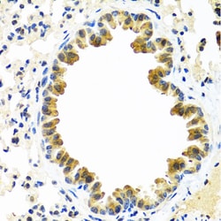 Invitrogen CRTAP Polyclonal Antibody 100 &mu;L; Unconjugated:Antibodies,