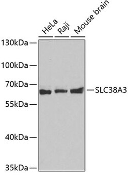 Invitrogen SLC38A3 Polyclonal Antibody 100 &mu;L; Unconjugated:Antibodies,