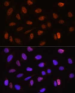 Invitrogen CSTF2T Polyclonal Antibody 100 &mu;L; Unconjugated:Antibodies,
