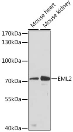 Invitrogen EML2 Polyclonal Antibody 100 &mu;L; Unconjugated:Antibodies,