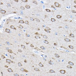 Invitrogen PTPN23 Polyclonal Antibody 100 &mu;L | Buy Online | Invitrogen&trade; | Fisher Scientific