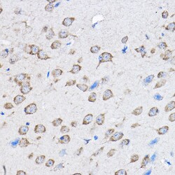 Invitrogen PTPN23 Polyclonal Antibody 100 &mu;L | Buy Online | Invitrogen&trade; | Fisher Scientific