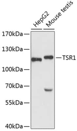 Invitrogen TSR1 Polyclonal Antibody 100 &mu;L | Buy Online | Invitrogen&trade; | Fisher Scientific