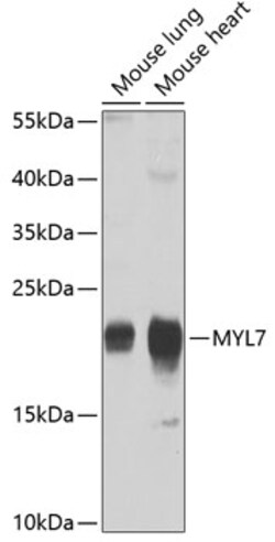 Invitrogen MYL7 Polyclonal Antibody 100 &mu;L; Unconjugated:Antibodies,