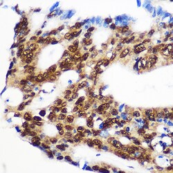 Invitrogen RBM15 Polyclonal Antibody 100 &mu;L; Unconjugated:Antibodies,