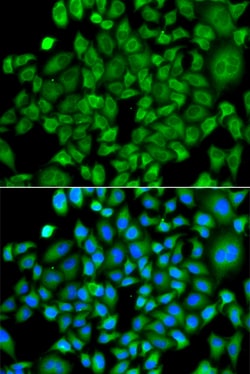 Invitrogen NAT13 Polyclonal Antibody 100 &mu;L; Unconjugated:Antibodies,