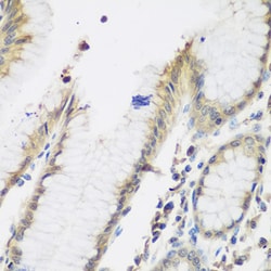 Invitrogen NAT13 Polyclonal Antibody 100 &mu;L; Unconjugated:Antibodies,
