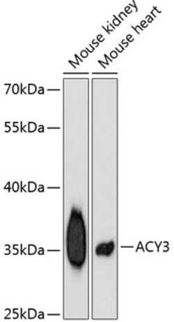 Invitrogen ACY3 Polyclonal Antibody 100 &mu;L; Unconjugated:Antibodies,