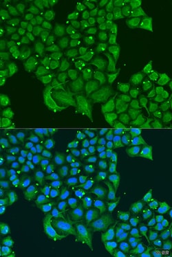 Invitrogen ATPIF1 Polyclonal Antibody 100 &mu;L; Unconjugated:Antibodies,