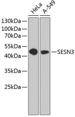 Invitrogen SESN3 Polyclonal Antibody 100 &mu;L; Unconjugated:Antibodies,
