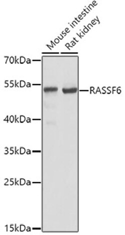Invitrogen RASSF6 Polyclonal Antibody 100 &mu;L; Unconjugated:Antibodies,