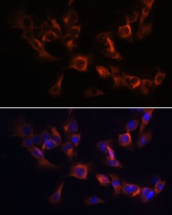 Invitrogen ARL13B Polyclonal Antibody 100 &mu;L; Unconjugated:Antibodies,