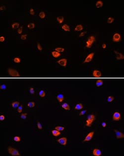 Invitrogen ARL13B Polyclonal Antibody 100 &mu;L; Unconjugated:Antibodies,