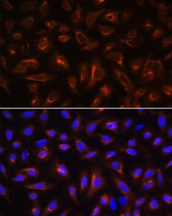 Invitrogen ARL13B Polyclonal Antibody 100 &mu;L; Unconjugated:Antibodies,