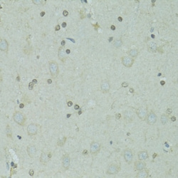 Invitrogen GTF2H2C Polyclonal Antibody 100 &mu;L; Unconjugated:Antibodies,