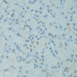 Invitrogen GTF2H2C Polyclonal Antibody 100 &mu;L; Unconjugated:Antibodies,