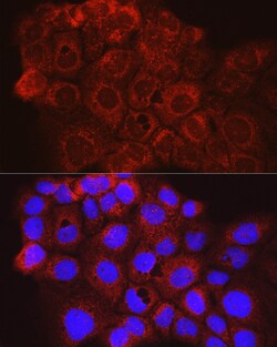 Invitrogen CD63 Polyclonal Antibody 100 &mu;L; Unconjugated:Antibodies,