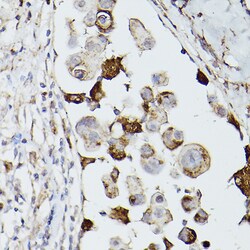 Invitrogen CD63 Polyclonal Antibody 100 &mu;L; Unconjugated:Antibodies,