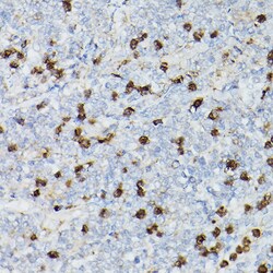 Invitrogen CD63 Polyclonal Antibody 100 &mu;L; Unconjugated:Antibodies,