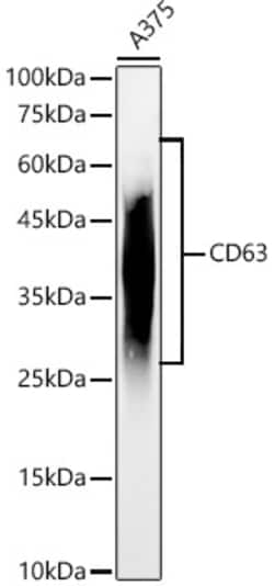 Invitrogen CD63 Polyclonal Antibody 100 &mu;L; Unconjugated:Antibodies,