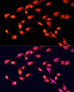 Invitrogen H3K14me3 Polyclonal Antibody 100 &mu;L; Unconjugated:Antibodies,