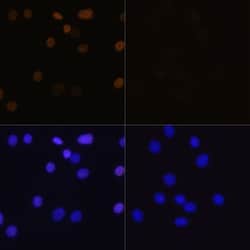Invitrogen H4K16ac Polyclonal Antibody 100 &mu;L | Buy Online | Invitrogen&trade; | Fisher Scientific