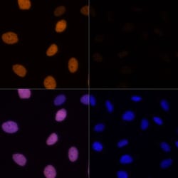 Invitrogen H4K16ac Polyclonal Antibody 100 &mu;L | Buy Online | Invitrogen&trade; | Fisher Scientific