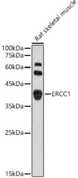 Invitrogen ERCC1 Polyclonal Antibody 100 &mu;L; Unconjugated:Antibodies,