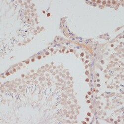 Invitrogen Cyclin G1 Polyclonal Antibody 100 &mu;L; Unconjugated:Antibodies,