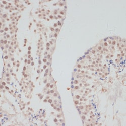 Invitrogen Cyclin G1 Polyclonal Antibody 100 &mu;L; Unconjugated:Antibodies,