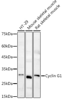 Invitrogen Cyclin G1 Polyclonal Antibody 100 &mu;L; Unconjugated:Antibodies,