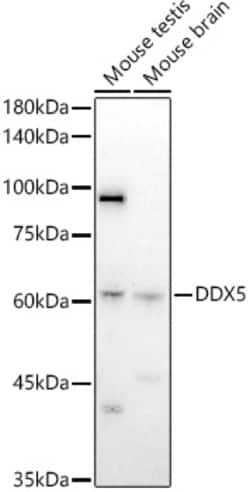 Invitrogen DDX5 Polyclonal Antibody 100 &mu;L; Unconjugated:Antibodies,